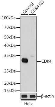 [KO Validated] CDK4 Rabbit pAb