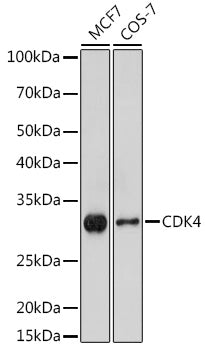 [KO Validated] CDK4 Rabbit pAb