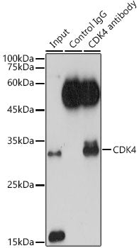[KO Validated] CDK4 Rabbit pAb