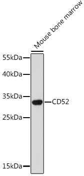 CD52 Rabbit pAb