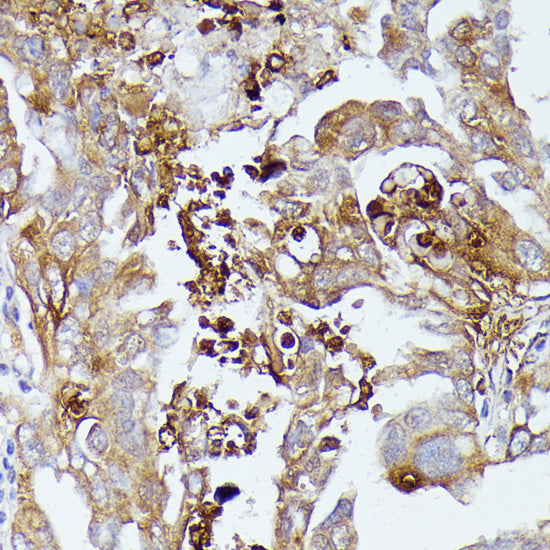 CD52 Rabbit pAb