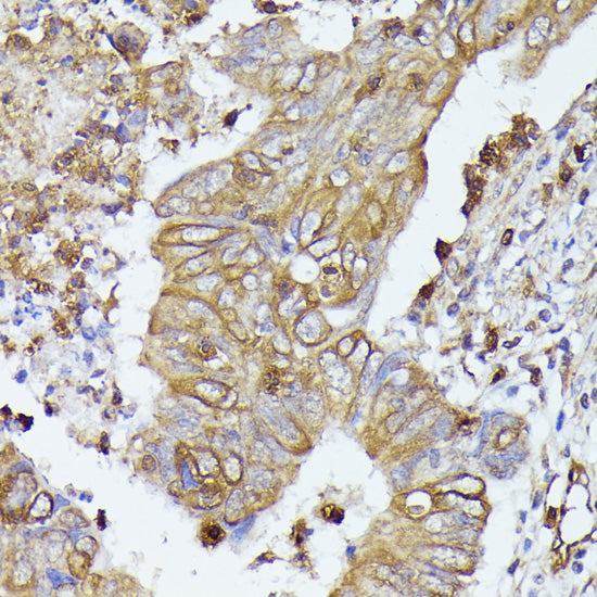 CD52 Rabbit pAb