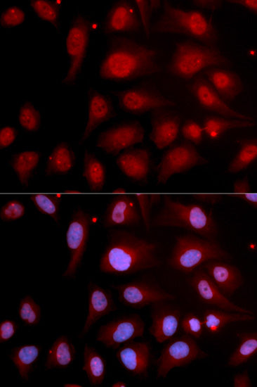 [KO Validated] DNA Polymerase beta Rabbit pAb
