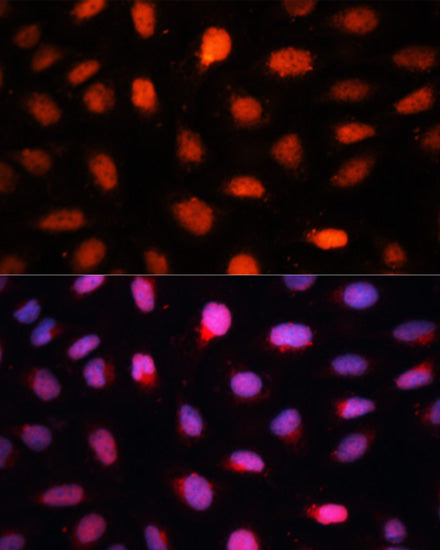 CTBP2 Rabbit pAb