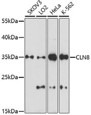 CLN8 Rabbit pAb