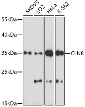 CLN8 Rabbit pAb