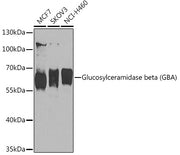 Glucosylceramidase beta (GBA) Rabbit pAb