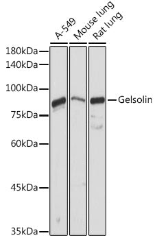 Gelsolin Rabbit pAb