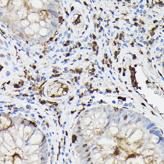 Gelsolin Rabbit pAb