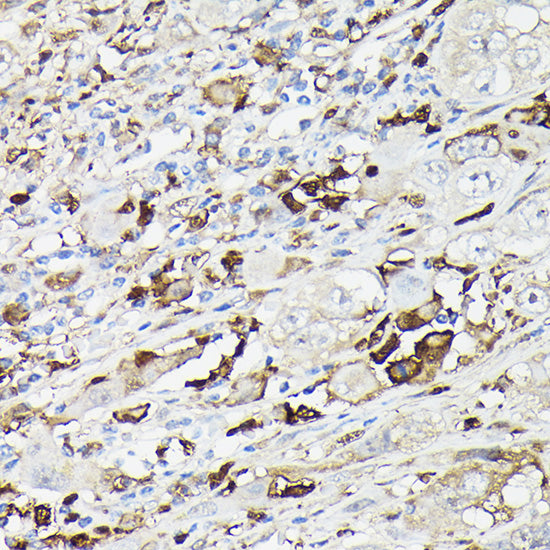 Gelsolin Rabbit pAb
