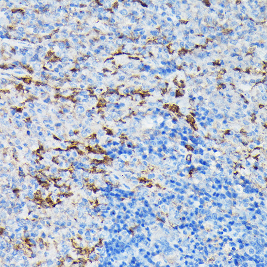 Gelsolin Rabbit pAb