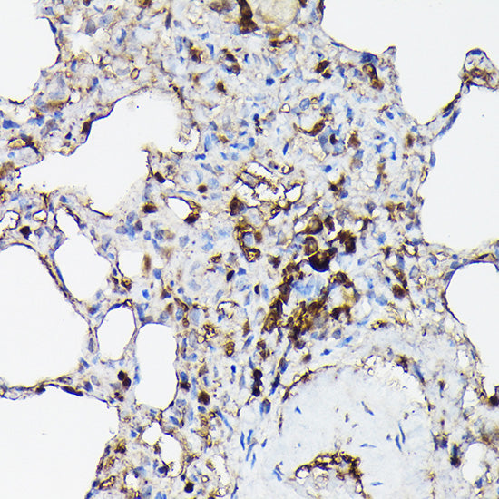 Gelsolin Rabbit pAb