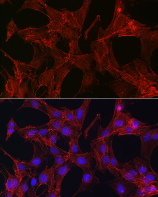 Gelsolin Rabbit pAb