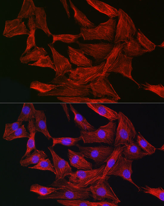 Gelsolin Rabbit pAb