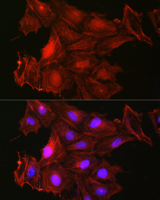 Gelsolin Rabbit pAb