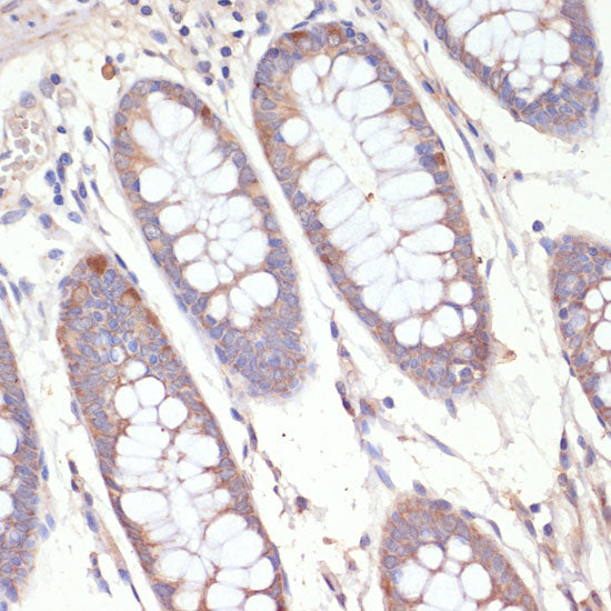 HMGCR Rabbit pAb