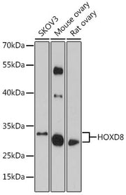 HOXD8 Rabbit pAb