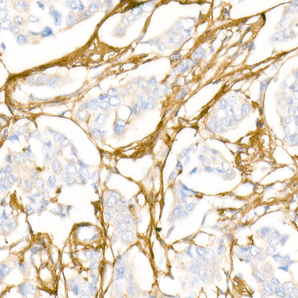 Collagen I/COL1A1 Rabbit pAb