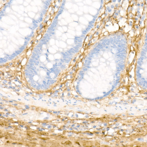 Collagen I/COL1A1 Rabbit pAb