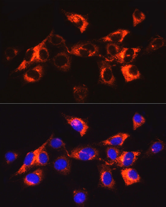Collagen I/COL1A1 Rabbit pAb