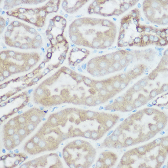 TOM20 Rabbit pAb