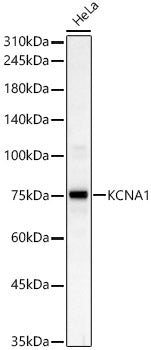 KCNA1 Rabbit pAb