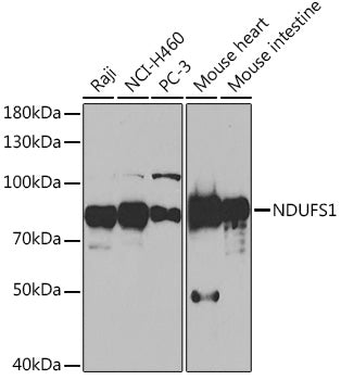 NDUFS1 Rabbit pAb