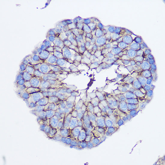 CD73/NT5E Rabbit pAb
