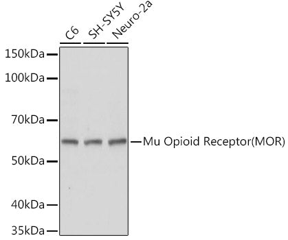 Mu Opioid Receptor(MOR) Rabbit pAb