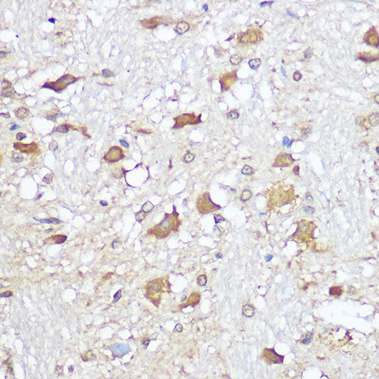 Mu Opioid Receptor(MOR) Rabbit pAb