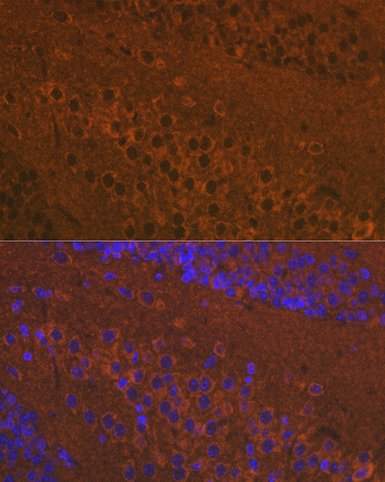Mu Opioid Receptor(MOR) Rabbit pAb