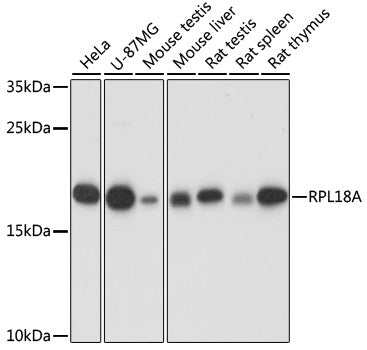 RPL18A Rabbit pAb