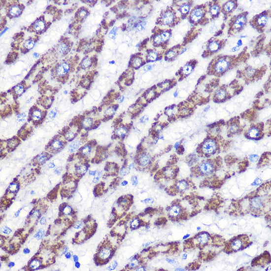 UCP3 Rabbit pAb