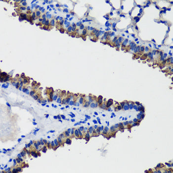 SCGB1A1 Rabbit pAb