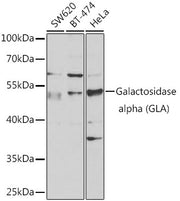 Galactosidase alpha (GLA) Rabbit pAb