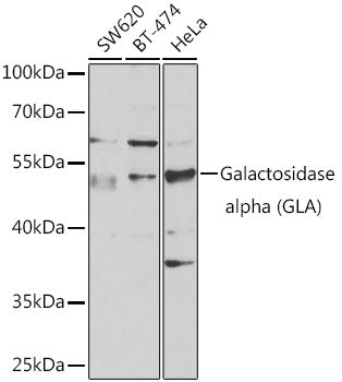 Galactosidase alpha (GLA) Rabbit pAb