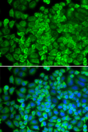 Galactosidase alpha (GLA) Rabbit pAb