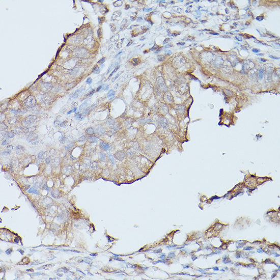 CD66a/CEACAM1 Rabbit pAb
