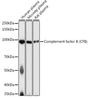 Complement factor B (CFB) Rabbit pAb