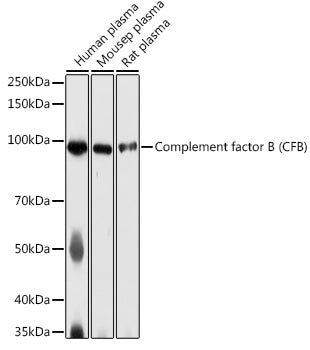 Complement factor B (CFB) Rabbit pAb