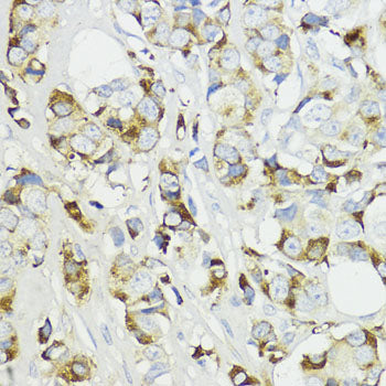 Complement factor B (CFB) Rabbit pAb