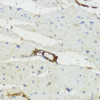 Complement factor B (CFB) Rabbit pAb