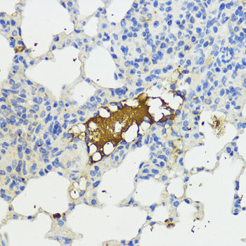 Complement factor B (CFB) Rabbit pAb
