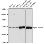 [KO Validated] βIII-Tubulin Rabbit pAb