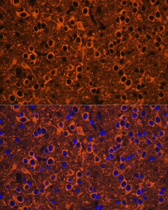 [KO Validated] βIII-Tubulin Rabbit pAb