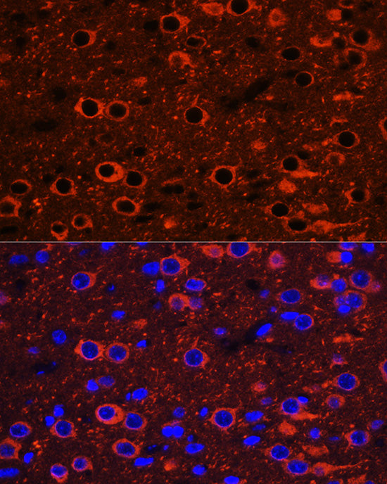 [KO Validated] βIII-Tubulin Rabbit pAb