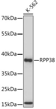 RPP38 Rabbit pAb