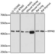 RPP40 Rabbit pAb