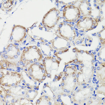PDCD10 Rabbit pAb
