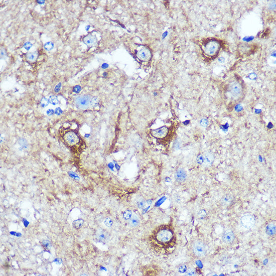 WWC1 Rabbit pAb